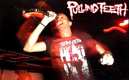 Pulling Teeth